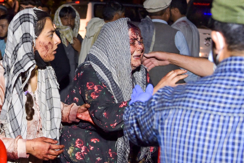 Mulheres feridas chegam a um hospital para tratamento após duas explosões no aeroporto de Cabul/Wakil Kohsar/AFP