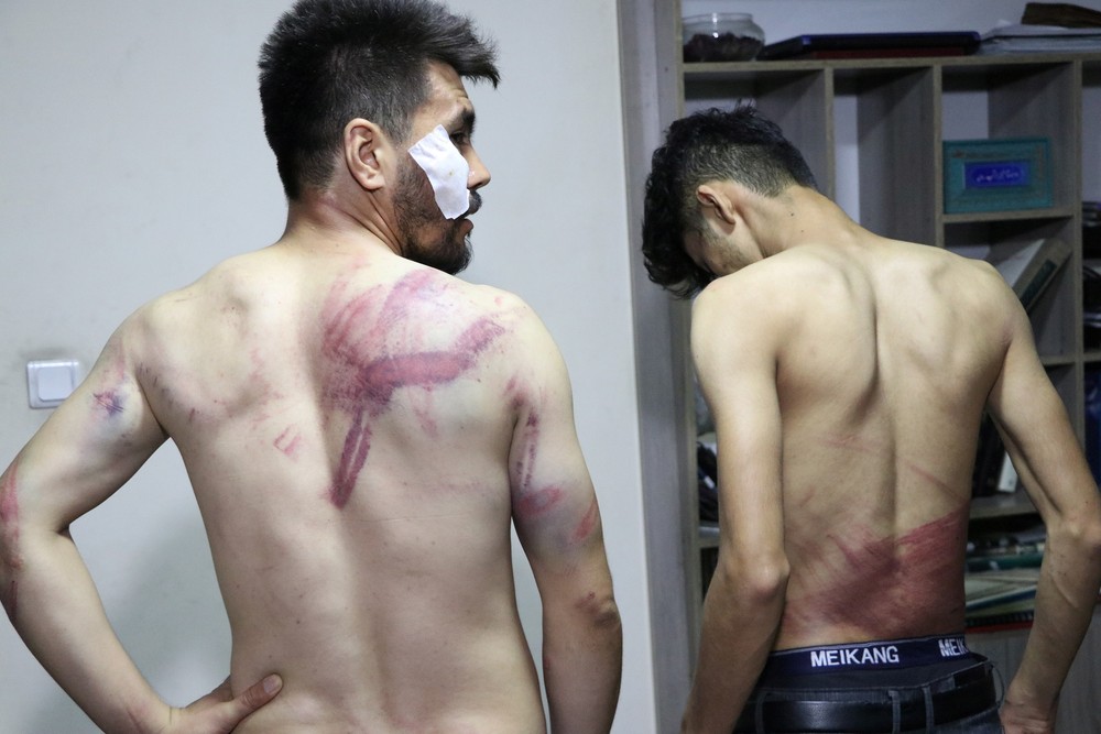 Jornalistas mostram ferimentos após serem espancados pelo Talibã em Cabul/Etilaatroz/via Reuters