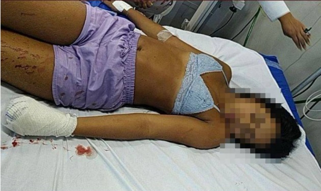 Punida Jovem que foi baleada na mão esquerda por traficantes da comunidade do Manguinhos está sob custódia Hospital Getúlio Vargas, na Zona Norte do Rio