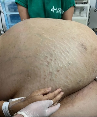 Paciente estava com o tumor há pelo menos 5 anos; mulher é natural de MG mas mora em Itaperuna/Reprodução/Instagram